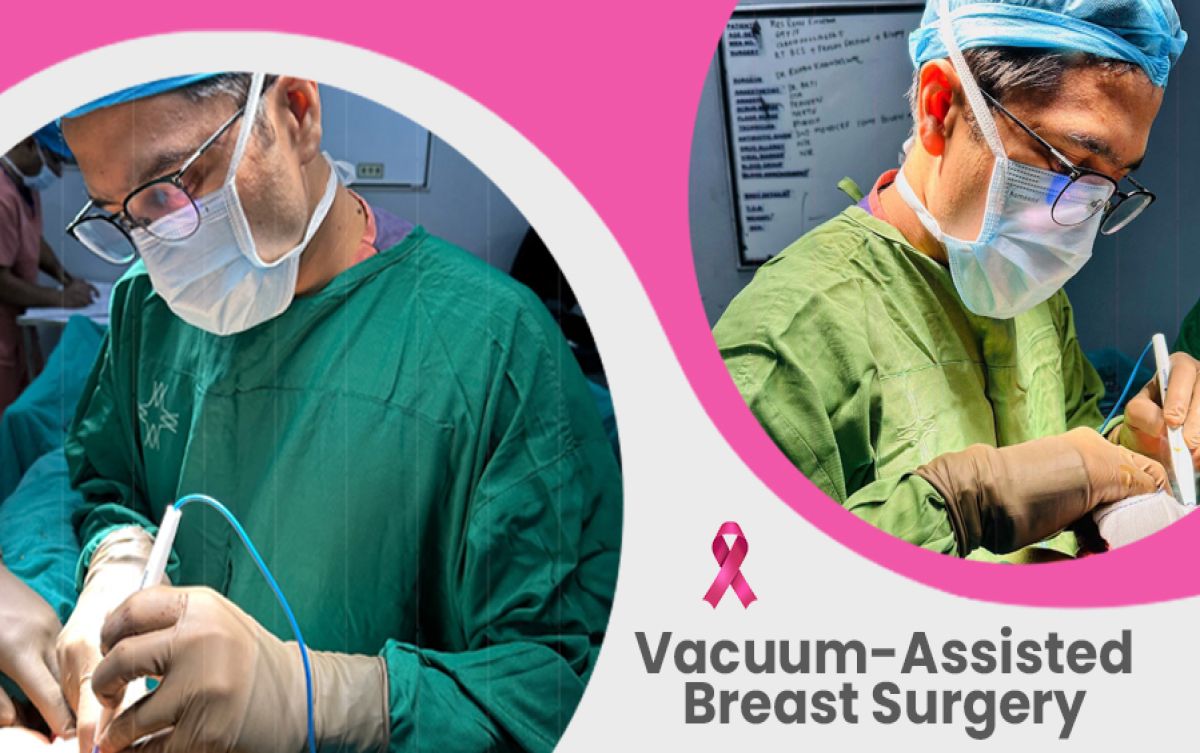 Is Vacuum-Assisted Breast Surgery a New Surgical Approach Gaining Popularity in India?