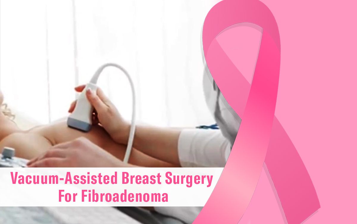 Vacuum-Assisted Breast Surgery For Fibroadenoma